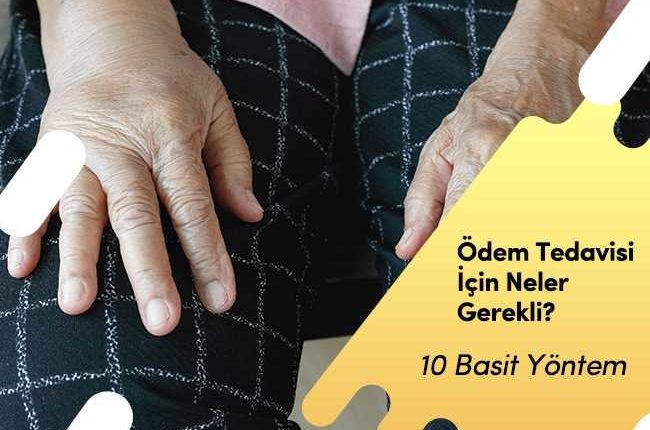 Ödem Atmak İçin Ne Yapmalı?