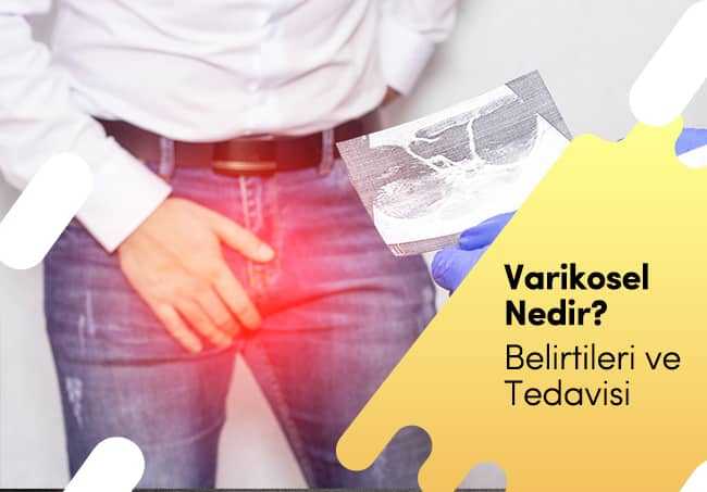 Varikosel Nedir, Belirtileri ve Tedavisi Faydaları &amp; Zararları